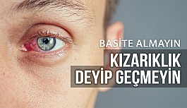 Göz Kızarıklığı Deyip Geçmeyin