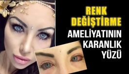Göz Rengi Ameliyatında Körlük Tehlikesi