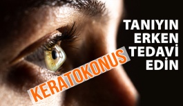 Keratokonusu Tanıyın, Erken Tedavi Edin!
