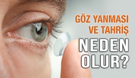 Kontak Lenslerin Neden Olduğu Göz Yanması ve Tahriş Nasıl Giderilir?