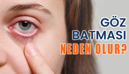 Göz Batması Neden Olur? Nasıl Geçer?