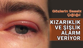 Göz Kapaklarında Kızarıklık Ve Şişlik Alarm Veriyor