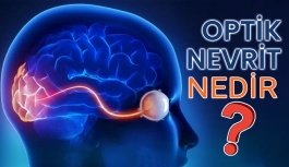 Optik Nevrit Nedir?