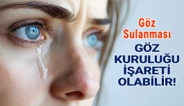 Göz Sulanması Göz Kuruluğu İşareti Olabilir