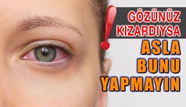 Gözleriniz Kızardıysa Asla Bunu Yapmayın!
