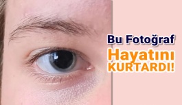 Paylaştığı Göz Fotoğrafı Hayatını Kurtardı!