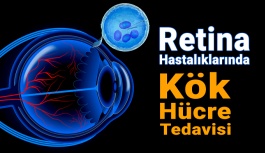 Retina Hastalıklarında Kök Hücre Tedavisi