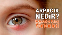 Arpacık Nedir? Belirtileri ve Tedavi Yöntemleri