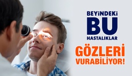 Beyindeki Bu Hastalıklar Gözleri Vurabiliyor!