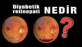 Diyabetik Retinopati Nedir?