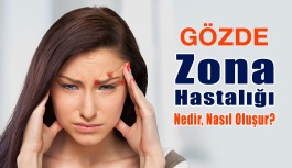 Gözde Zona Hastalığı: Nedir, Nasıl Oluşur?