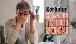 Glokom Körlüğün En Yaygın İkinci Nedeni