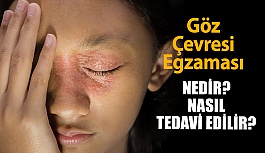 Göz Çevresi Egzaması Nedir? Nasıl Tedavi...