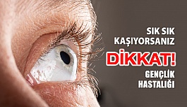 Gözünüzü Sık Sık Kaşıyorsanız Keratokonus...