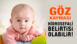 Göz Kayması Hidrosefali Belirtisi Olabilir!