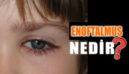 Enoftalmus Nedir?