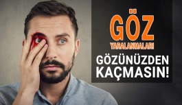 Göz Yaralanmaları Gözünüzden Kaçmasın!