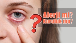Göz Kuruluğu ile Göz Alerjisi Arasındaki...